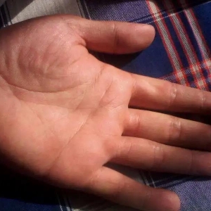 生命线绕到大拇指后方，是好是坏？男女不同如何看生命线？