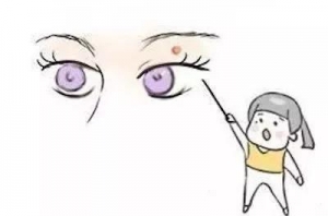 这两个部位有痣、斑、疤，容易漏财破财！一辈子辛苦劳累